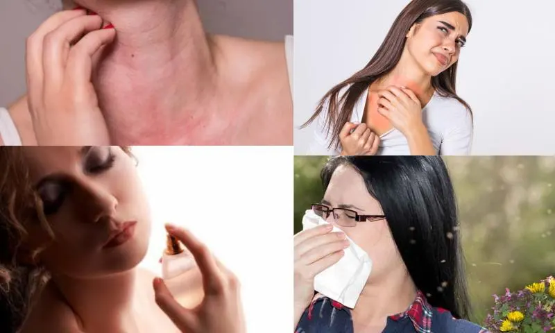Koku Alerjisi Nedir ve Belirtileri Nelerdir?