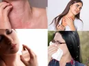 Koku Alerjisi Nedir ve Belirtileri Nelerdir?