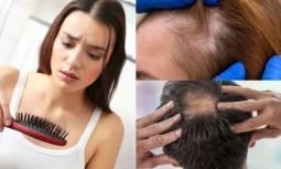 Saç Dökülmesine Karşı Şampuan Nasıl Seçilir?