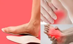 Morton Nöroma Yaşam Kalitesini Nasıl Etkiler?