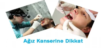 Ağız Kanserine Dikkat