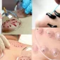 How Do Leeches Heal Diseases?