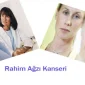Rahim Ağzı Kanserine Dikkat